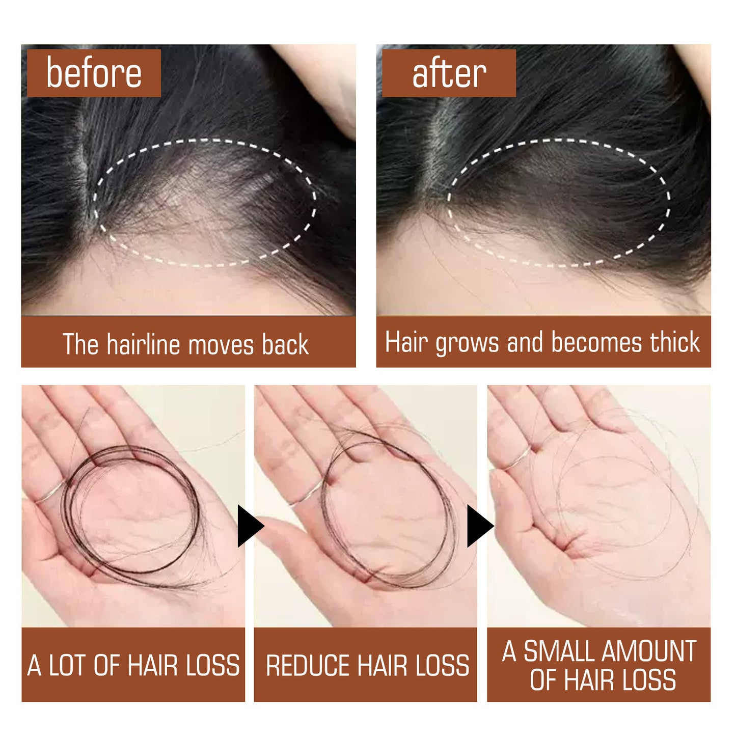 Huile Conditionneur pour Cheveux Anti-chute